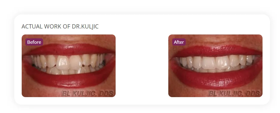 Actual orthodontics work of dr. Kuljic