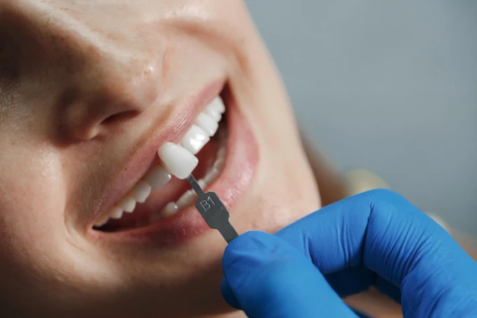 custom porcelain veneers at Kuljic DDS & Team in Beverly, MA
