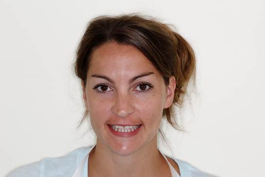 Patient before porcelain veneers close a front tooth gap