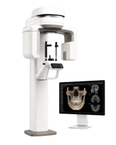 Panoramic dental x-ray machine used for early diagnosis