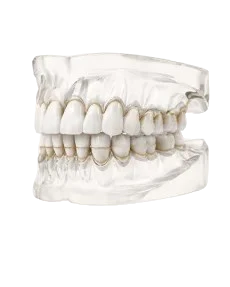 Dental model showing how upper and lower teeth align